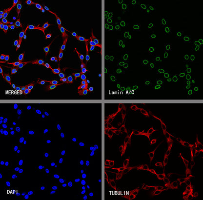 Lamin A/C Recombinant Rabbit mAb (S-5671)