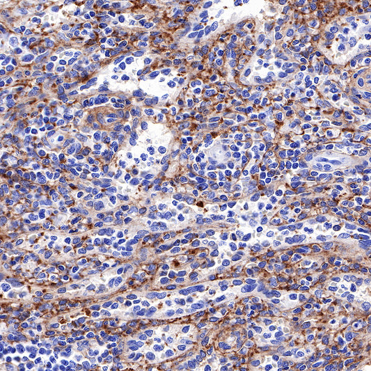 CD226 Recombinant Rabbit mAb (SDT-284-30)