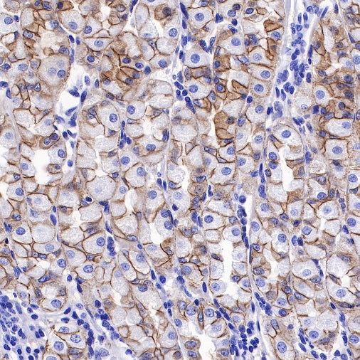 E-Cadherin Recombinant Rabbit mAb (SDT-438-45)