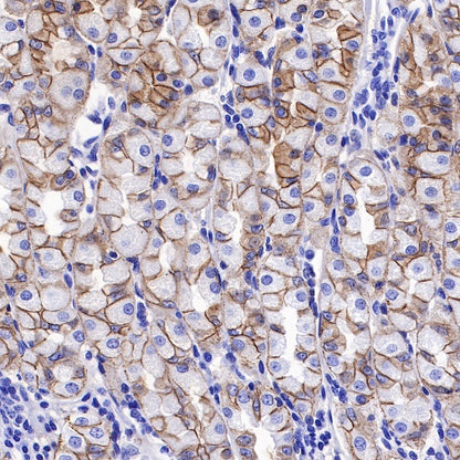 E-Cadherin Recombinant Rabbit mAb (SDT-438-45)