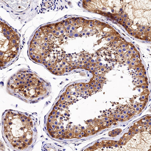 PKM2 Rabbit Polyclonal antibody