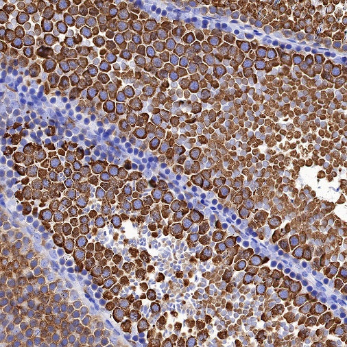 DDX4 Recombinant Rabbit mAb (S-1570-48)