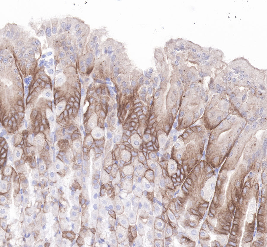 LDL receptor Recombinant Rabbit  mAb (SDT-057-57)