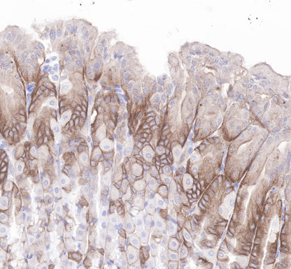 LDL receptor Recombinant Rabbit  mAb (SDT-057-57)