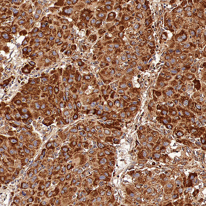 GOT2 Recombinant Rabbit mAb