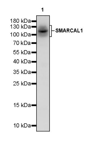 SMARCAL1 Recombinant Rabbit mAb (S-2110-328)