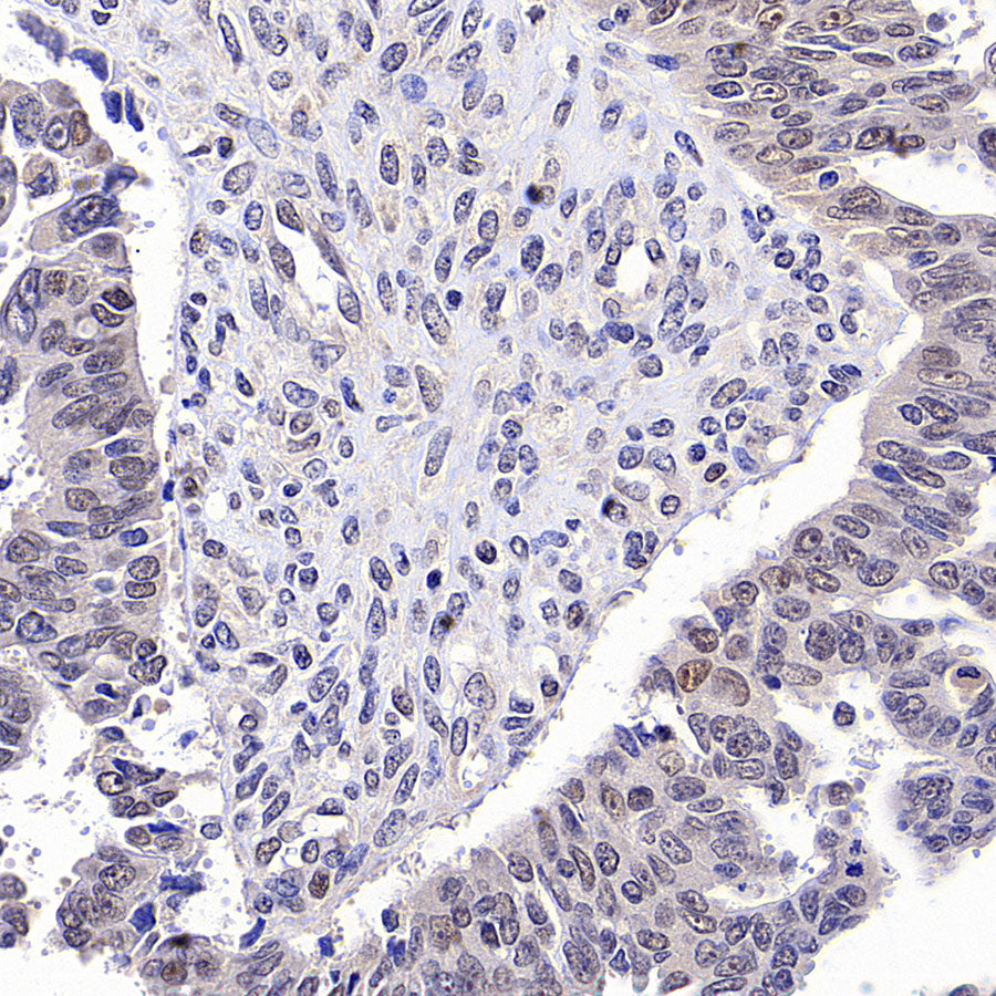 PAPSS1 Recombinant Rabbit mAb (S-3516-9)
