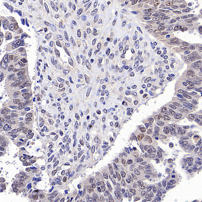 PAPSS1 Recombinant Rabbit mAb (S-3516-9)