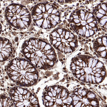 ISL2 Rabbit Polyclonal Antibody