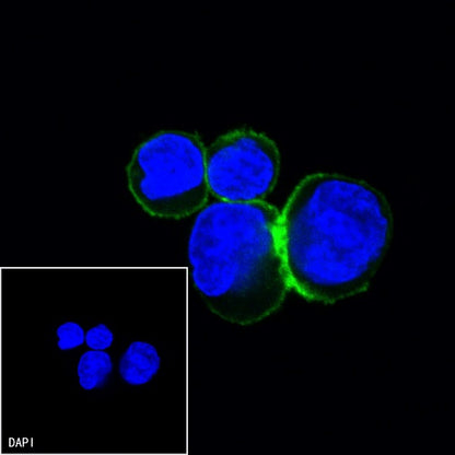 CD20 Recombinant Rabbit mAb (Alexa Fluor® 488 Conjugate) (S-R133)