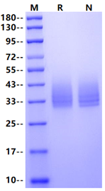 IL-10 R beta His Tag Protein, Mouse