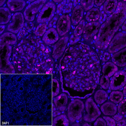 Stat6 Recombinant Rabbit mAb (Alexa Fluor® 647 Conjugate) (SDT-337-32)