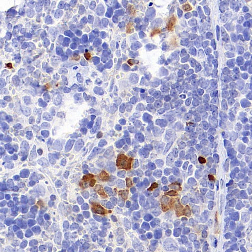 Mouse IL-6 Recombinant  mAb (S-1630-38)