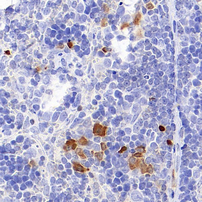 Mouse IL-6 Recombinant  mAb (S-1630-38)