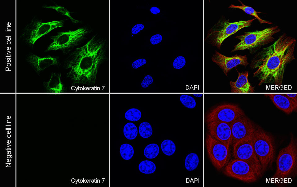 S-RMab® Cytokeratin 7 Recombinant Rabbit  mAb,PBS Only (SDT-121-17)