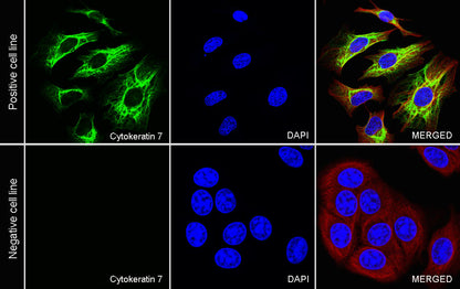S-RMab® Cytokeratin 7 Recombinant Rabbit  mAb,PBS Only (SDT-121-17)