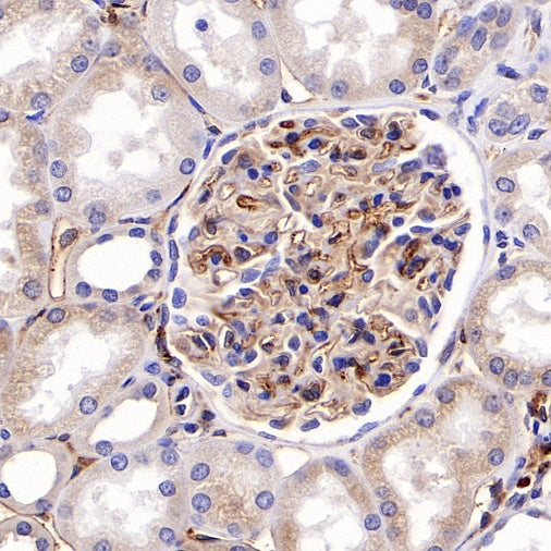 HLA-DRB1 Recombinant Rabbit mAb (SDT-R253)