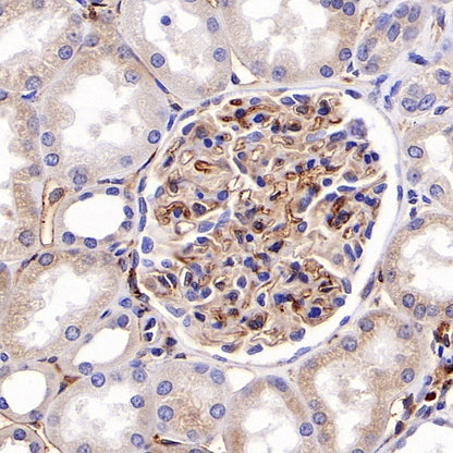 HLA-DRB1 Recombinant Rabbit mAb (SDT-R253)