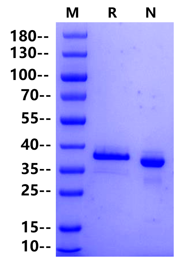 ACVR2B His Tag Protein, Human
