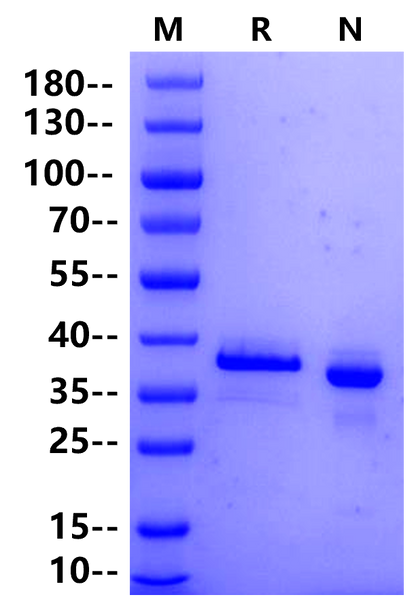 ACVR2B His Tag Protein, Human