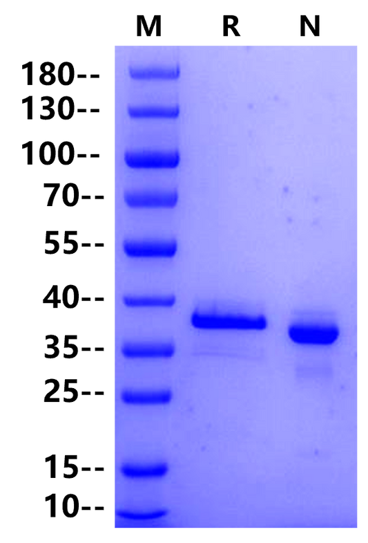 ACVR2B His Tag Protein, Human