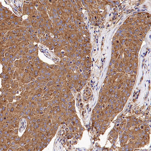 Clathrin heavy chain Recombinant Rabbit mAb (S-1690-25)