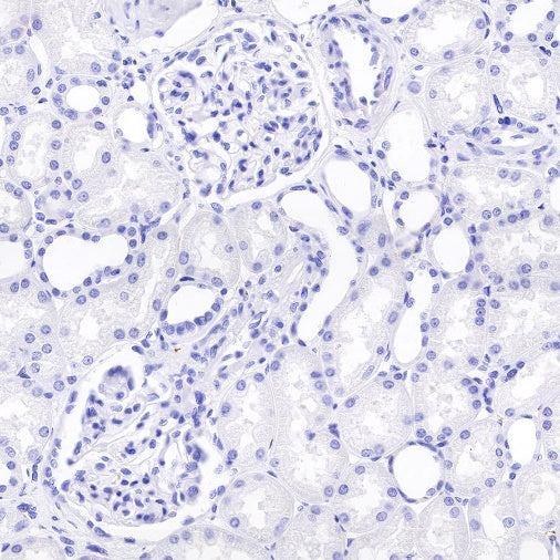 Synapsin-1 Recombinant Rabbit mAb (S-550-7)
