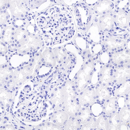 Synapsin-1 Recombinant Rabbit mAb (S-550-7)