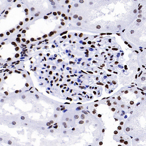 Histone H4 (acetyl K5 + K8 + K12 + K16) Recombinant Rabbit mAb (S-902-37)
