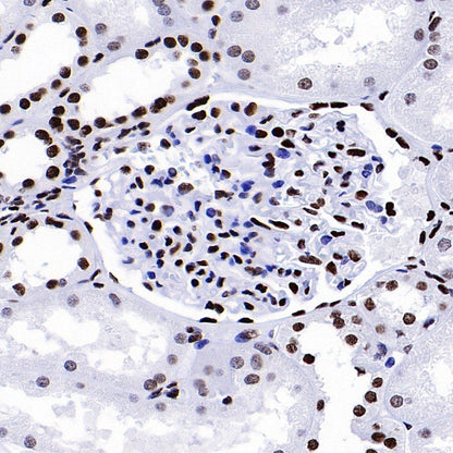 Histone H4 (acetyl K5 + K8 + K12 + K16) Recombinant Rabbit mAb (S-902-37)