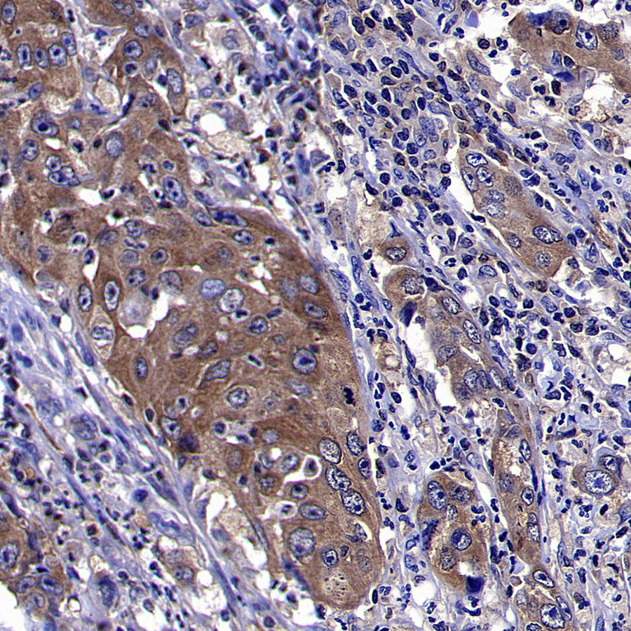 ARF6 Recombinant Rabbit mAb (S-4283-62)