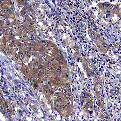 ARF6 Recombinant Rabbit mAb (S-4283-62)