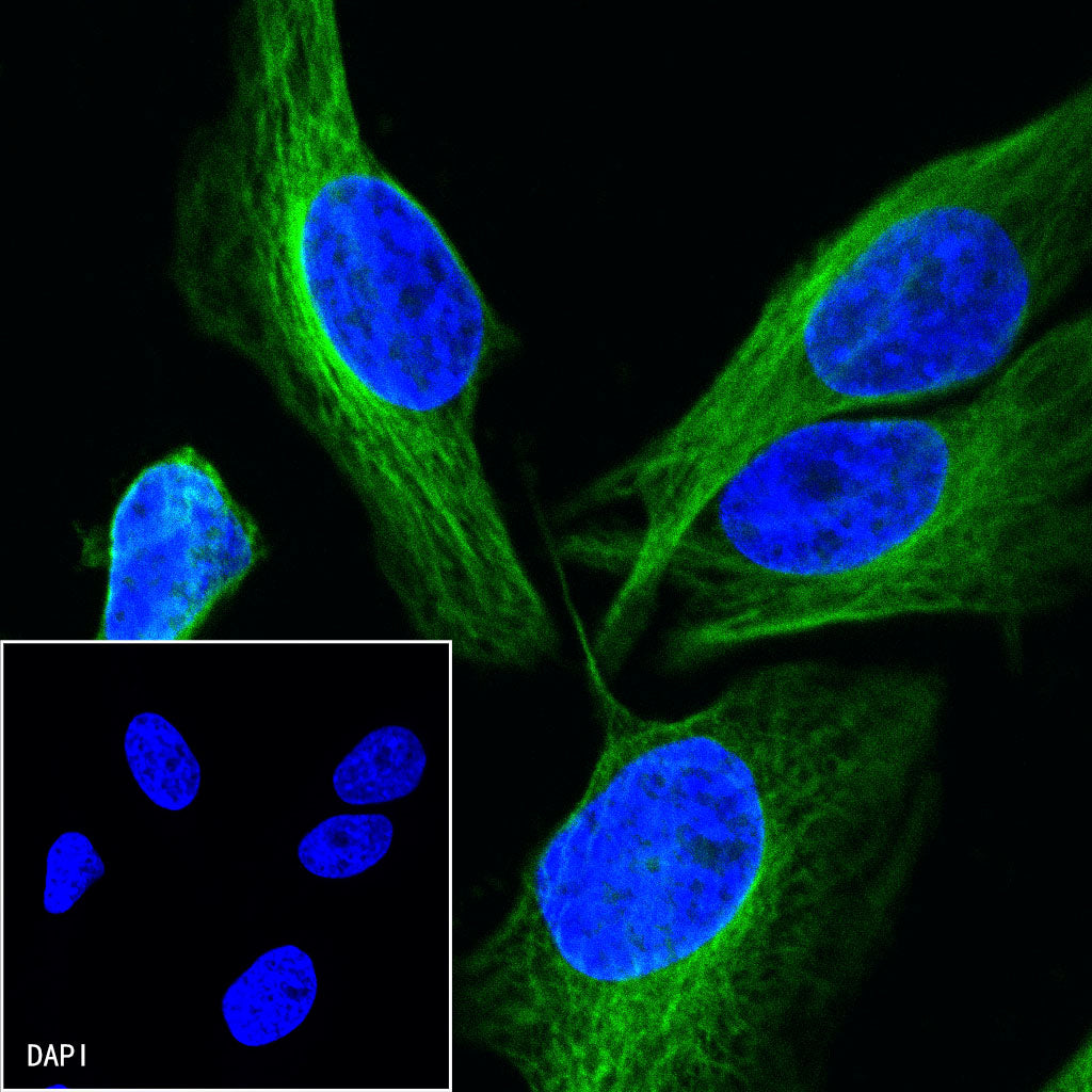 Beta II tubulin Rabbit polyclonal antibody