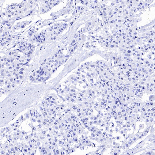 SEZ6 Recombinant Rabbit mAb (SDT-2097-7)