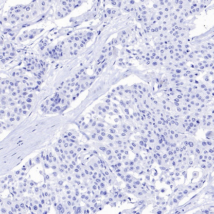 SEZ6 Recombinant Rabbit mAb (SDT-2097-7)