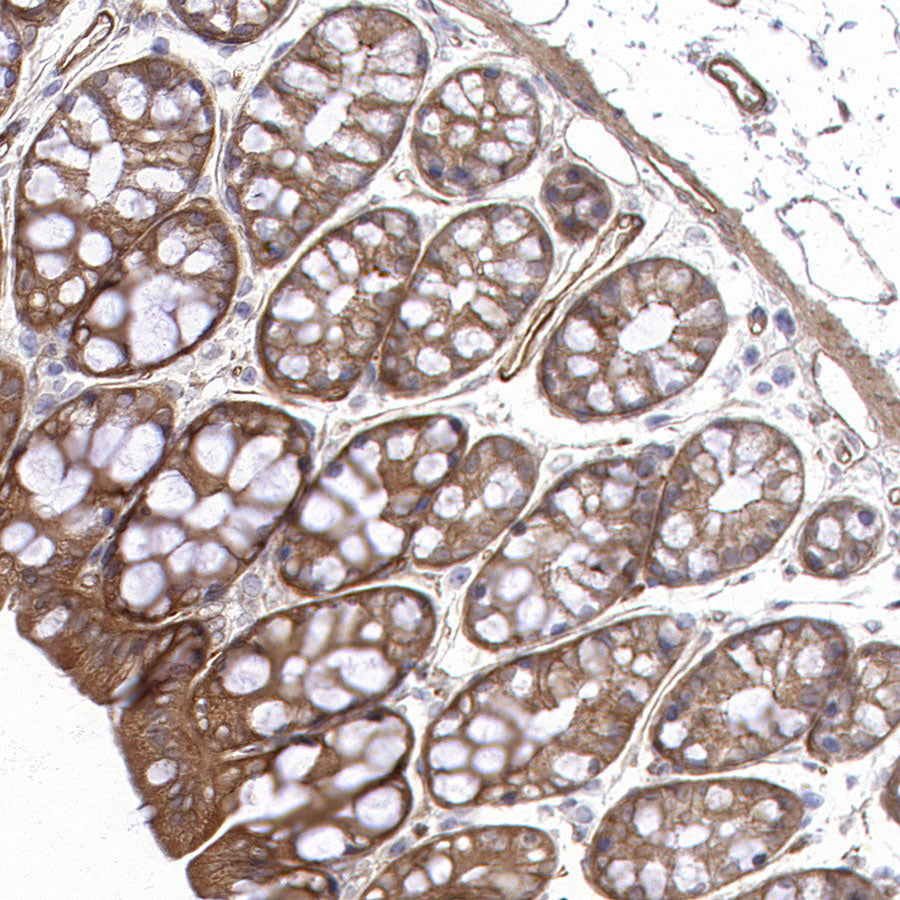 BCAR1 Recombinant Rabbit mAb (S-3542-49)