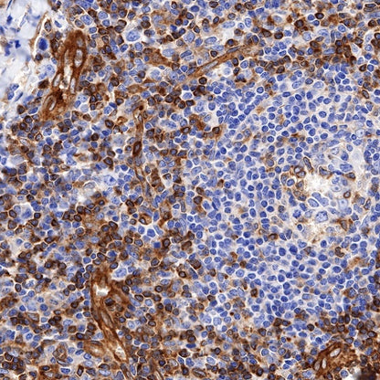 Paxillin Recombinant Rabbit mAb (S-619-12)