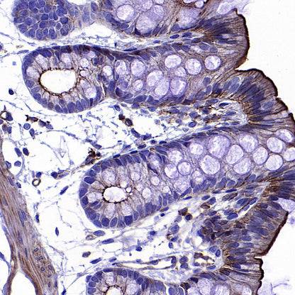 β-Actin Recombinant Rabbit mAb (S-5701)