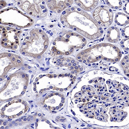 AMPKβ1/2 Recombinant Rabbit mAb (S-2728-26)