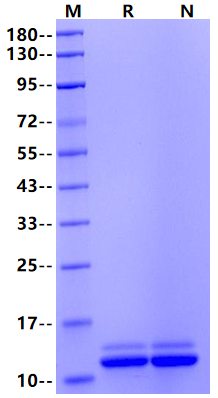 ITPRIPL1 His Tag Protein, Human