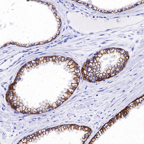 TACSTD2/TROP2 Recombinant Rabbit mAb (S-R238)