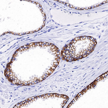 TACSTD2/TROP2 Recombinant Rabbit mAb (S-R238)