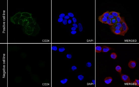 CD24 Recombinant Rabbit mAb (S-974-13)