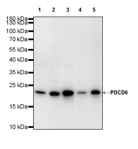 PDCD6 Recombinant Rabbit mAb (S-578-98)