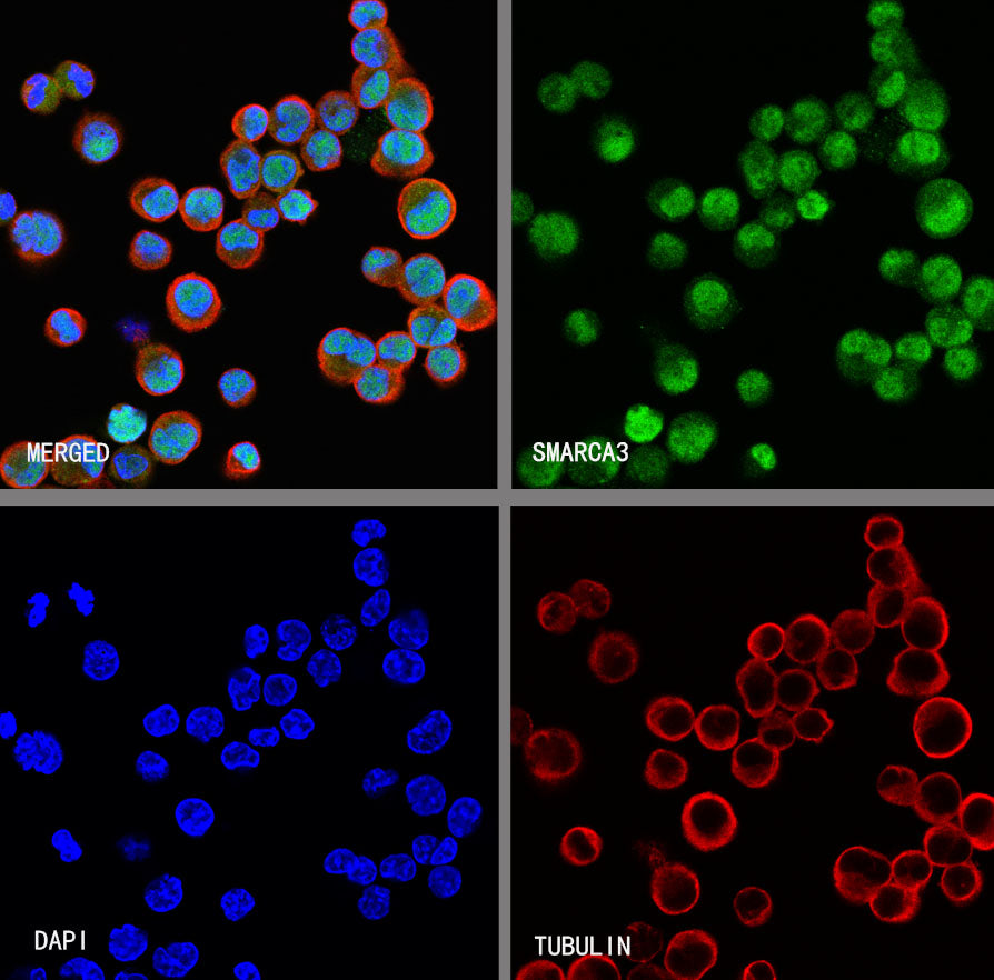 SMARCA3 Recombinant Rabbit mAb (S-3575-154)