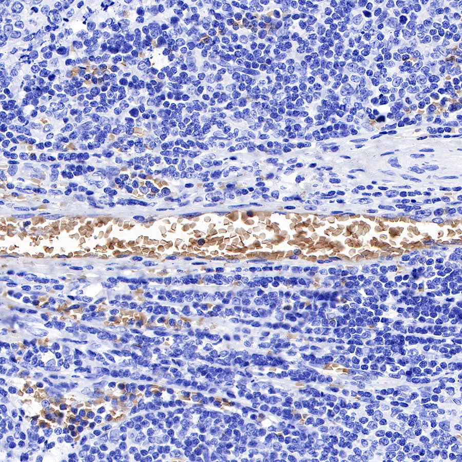 Hemoglobin Recombinant Rabbit mAb (SDT-193-71)