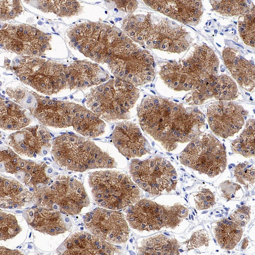 SEC23B Recombinant Rabbit mAb (S-1935-28)