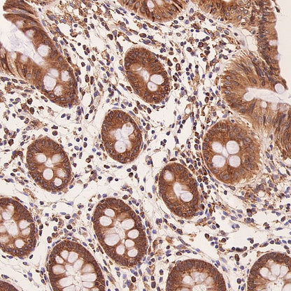 ERAP1 Recombinant Rabbit mAb (S-2509-38)
