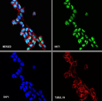 HAT1 Recombinant Rabbit mAb (S-2429-14)