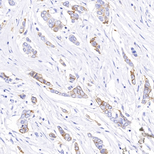 B7-H4 Recombinant Rabbit mAb (SDT-314-447-2)